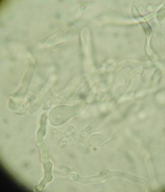 Da determinare (Antrodia albida)